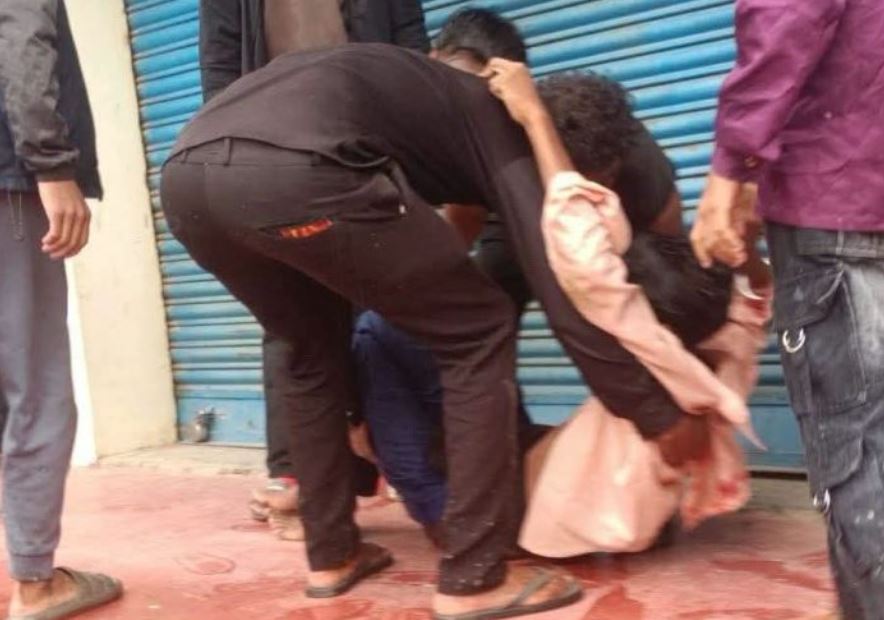 प्रहरीको गोली लागेर घाइते बालकको शरीरबाट निकालियो गोली